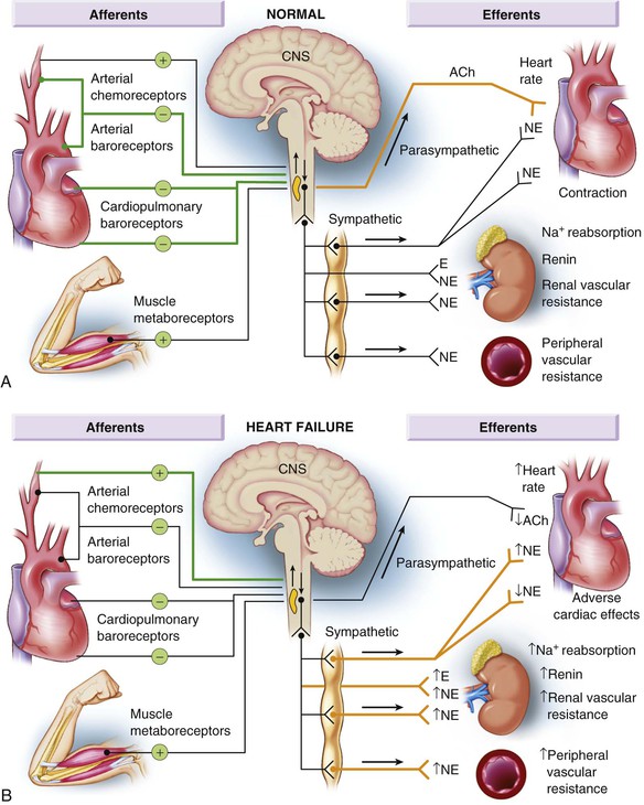 pathophysiology-of-heart-failure-thoracic-key