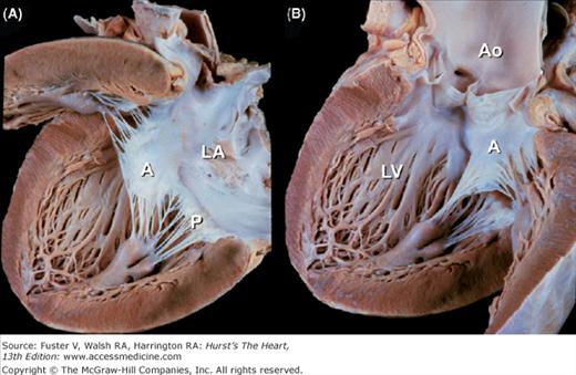 Functional Anatomy of the Heart | Thoracic Key