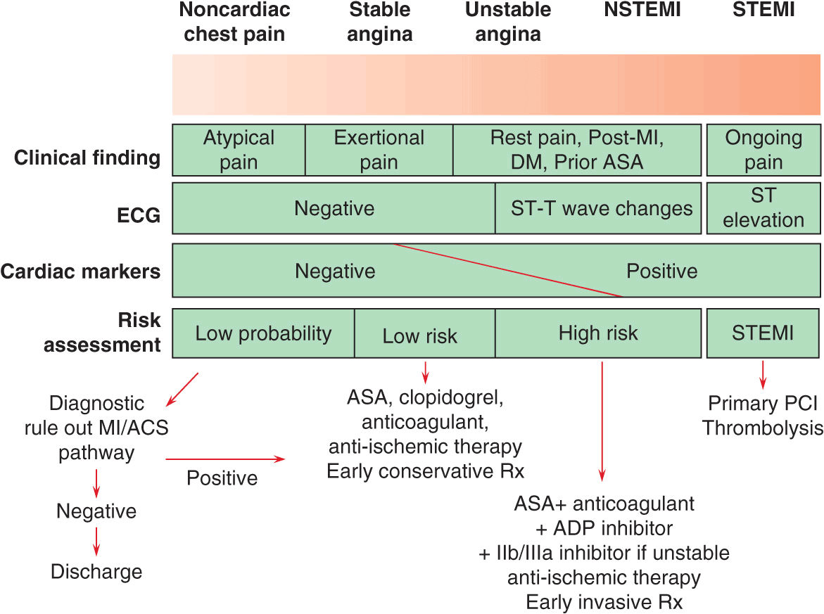 What are the different types of cardiac stress tests?