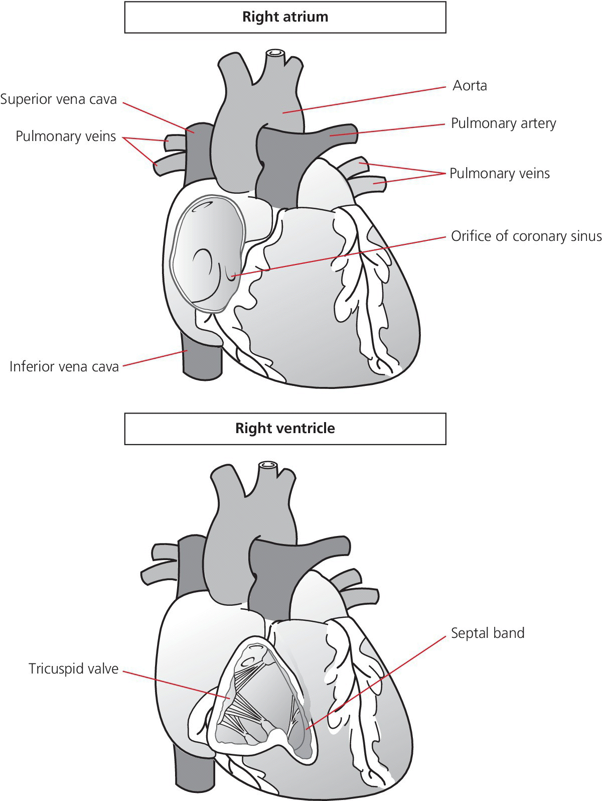 2 Illustrations of the heart displaying right atrium with lines depicting the aorta, pulmonary artery, pulmonary veins, etc. (top) and right ventricle with lines for the septal band and tricuspid valve (bottom).