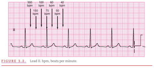 Interpretation Of The Normal Electrocardiogram Thoracic Key