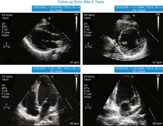 31 | Thoracic Key