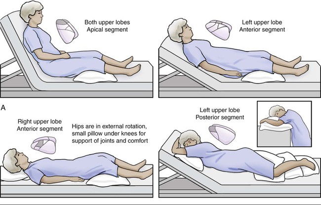 Airway Clearance Techniques Thoracic Key