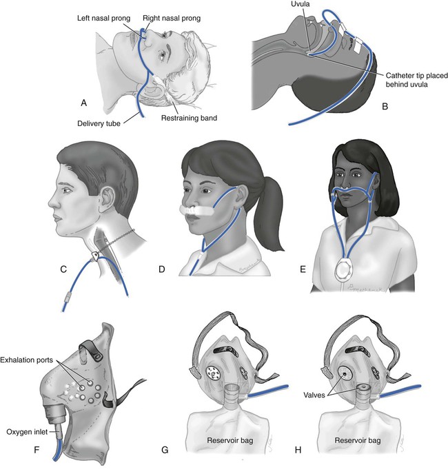 Transtracheal oxygen clearance cannula