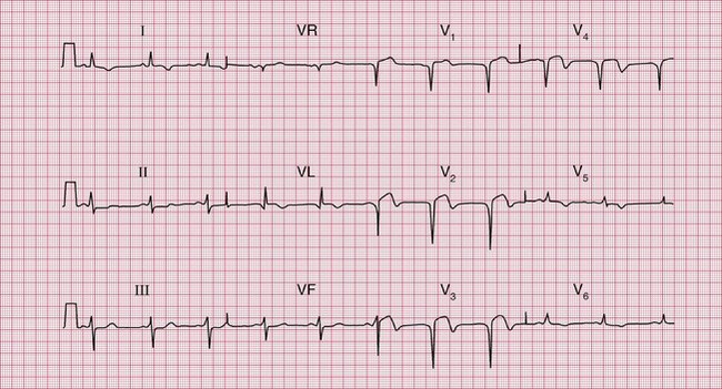 4 | Thoracic Key