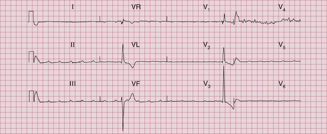 8 | Thoracic Key