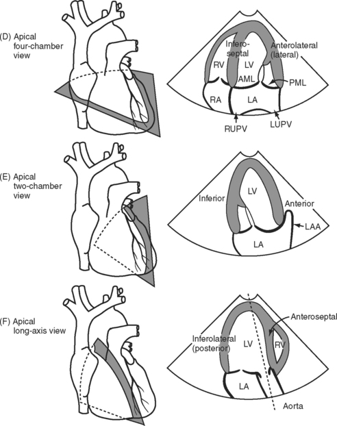 Echocardiography Chamber Views Echo Cardiac Subcostal Ultrasound ...