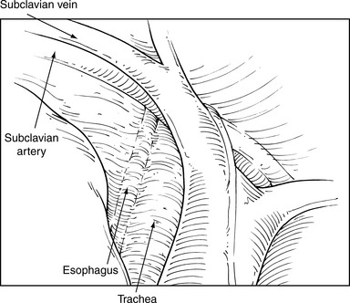 Applied Anatomy | Thoracic Key