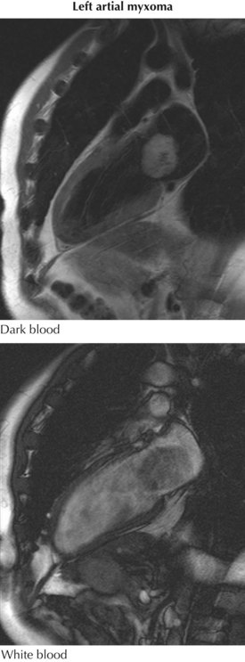 Chest Radiography | Thoracic Key