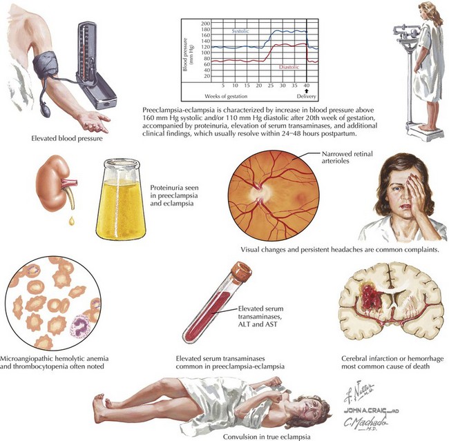 Substance Abuse And The Heart | Thoracic Key