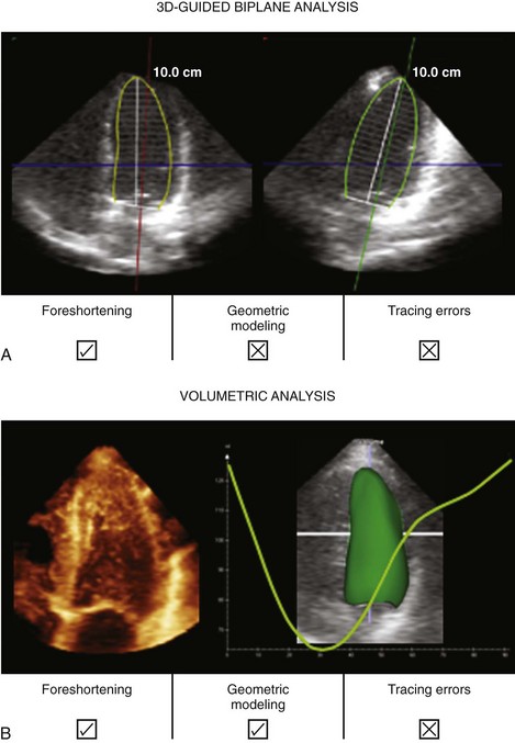 Transthoracic Three-Dimensional Echocardiography | Thoracic Key