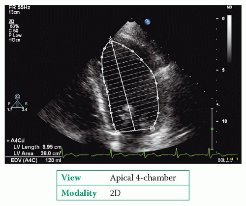 the-left-ventricle-and-its-systolic-function-thoracic-key