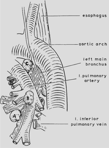 Lymphatics of the Lungs | Thoracic Key