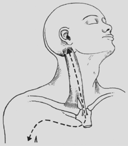 Anterior Approach To Superior Sulcus Lesions 