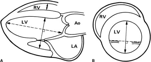 Transthoracic Echocardiography | Thoracic Key