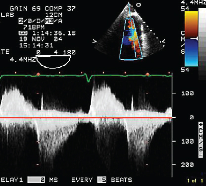 13 | Thoracic Key