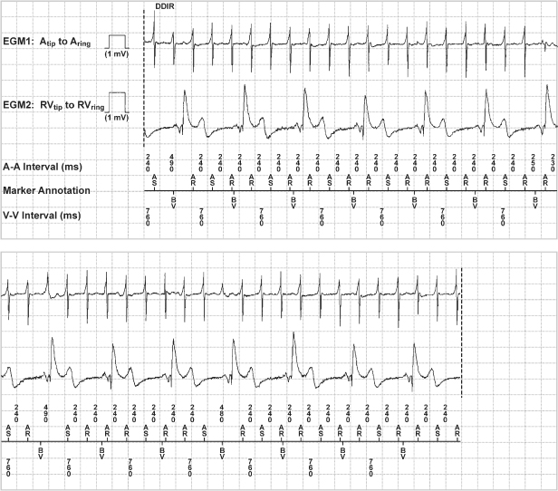 Follow-up | Thoracic Key