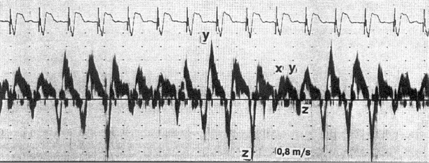 c3-fig-0011