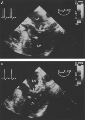 c3-fig-0014