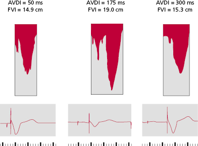 c3-fig-0022