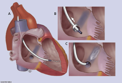 c9-fig-0006