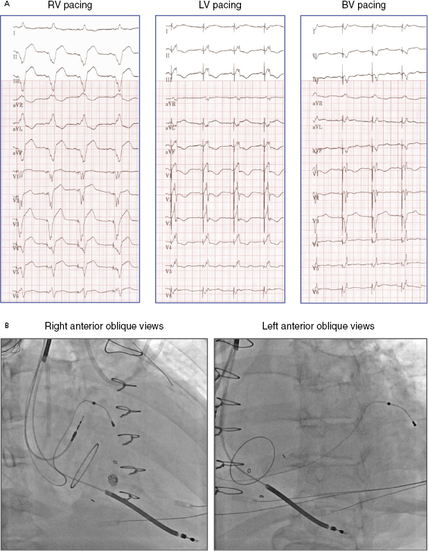 c9-fig-0014