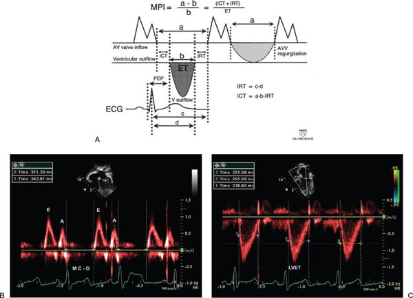 Quantitative Echocardiography—Basic | Thoracic Key