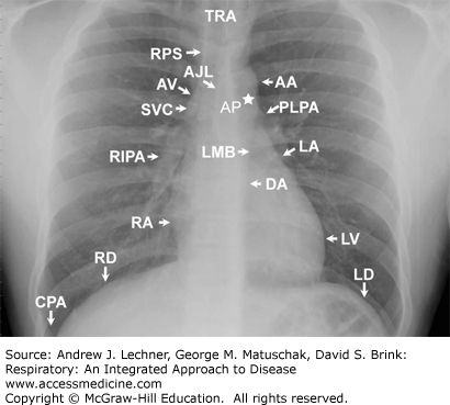 Interpreting Chest X Rays Ct Scans And Mris Thoracic Key