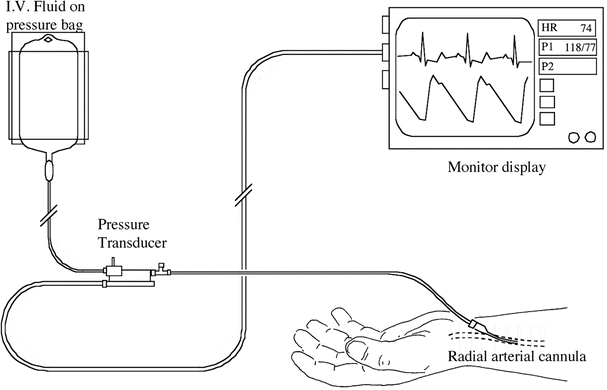 Monitoring and Managing the Critically Ill Patient in the Intensive ...