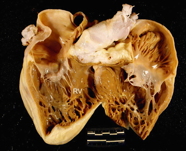 Comparative Cardiac Anatomy | Thoracic Key