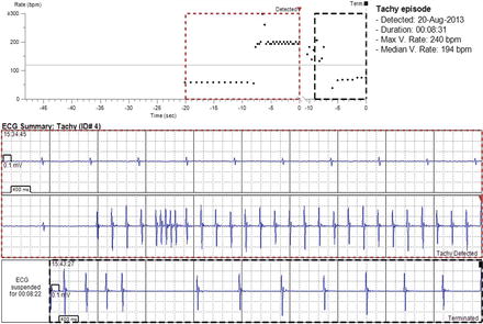 FV provides tilt table testing to safely and effectively diagnose syncope  due to Cardiovascular disease - FV Hospital