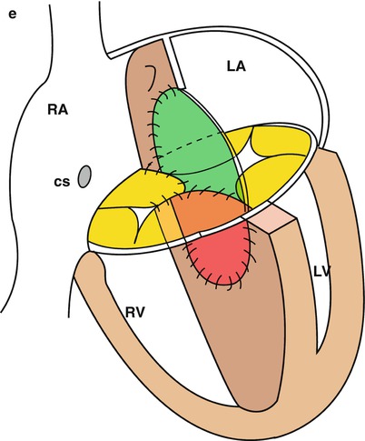 A316721_1_En_12_Fig4b_HTML.jpg