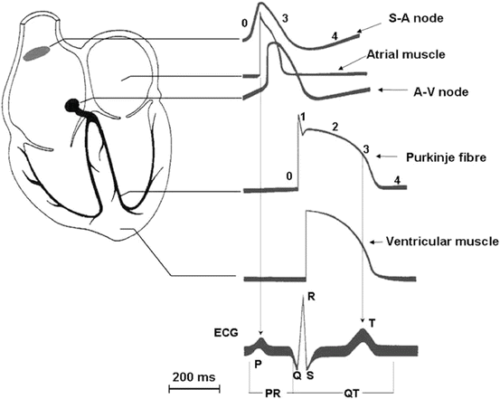 A321847_1_En_46_Fig1_HTML.gif