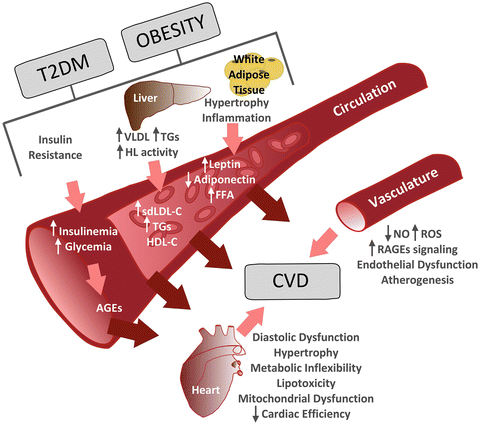 Diabetes Mellitus and Metabolic Syndrome | Thoracic Key