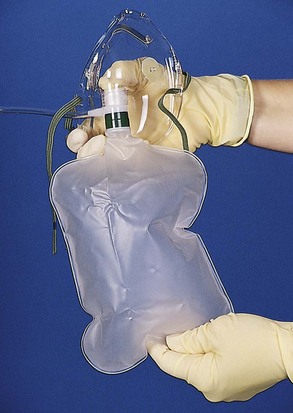 Airway Management Oxygenation And Ventilation Thoracic Key