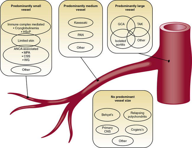 vasculitis classification