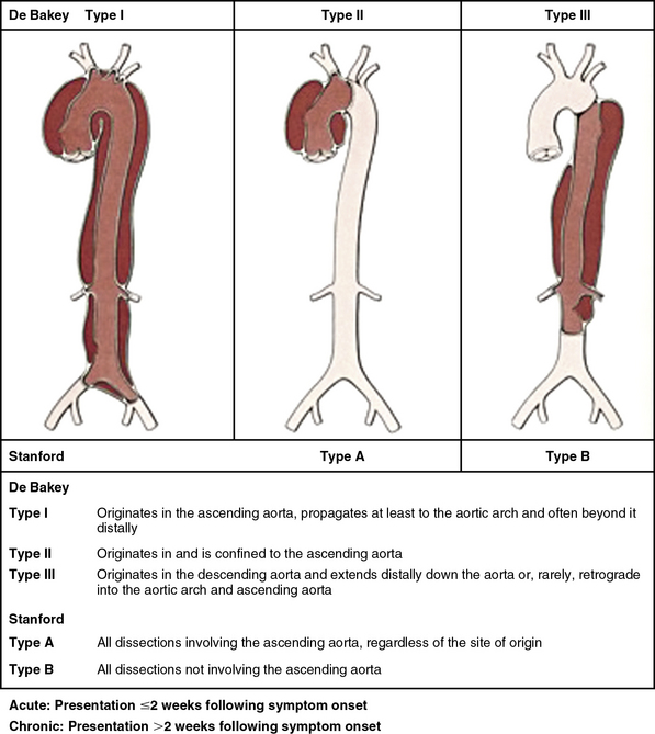 Pathophysiology Clinical Evaluation And Medical Management Of Aortic