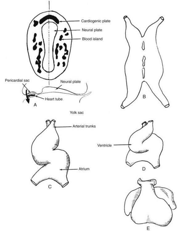 Embryology of the Vascular System | Thoracic Key