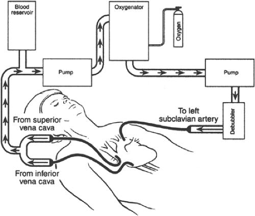 Cardiac Surgery Thoracic Key Cardiac Surgery Thoracic Key