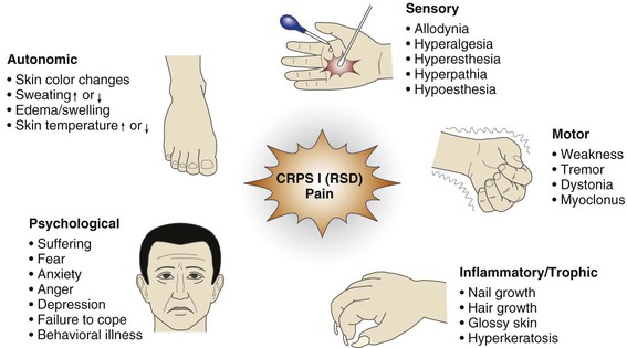 Complex Regional Pain Syndrome - LexiMed