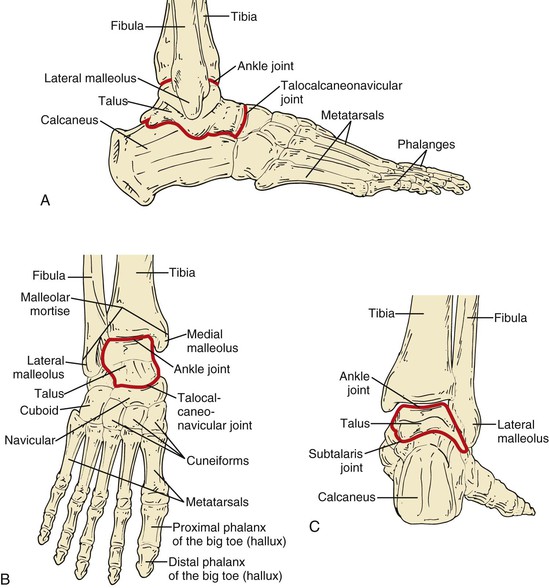 tarsometatarsal amputation