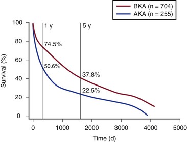 Lower Extremity Amputation | Thoracic Key