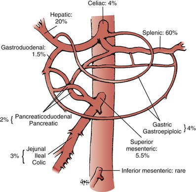 Splanchnic Artery Aneurysms | Thoracic Key