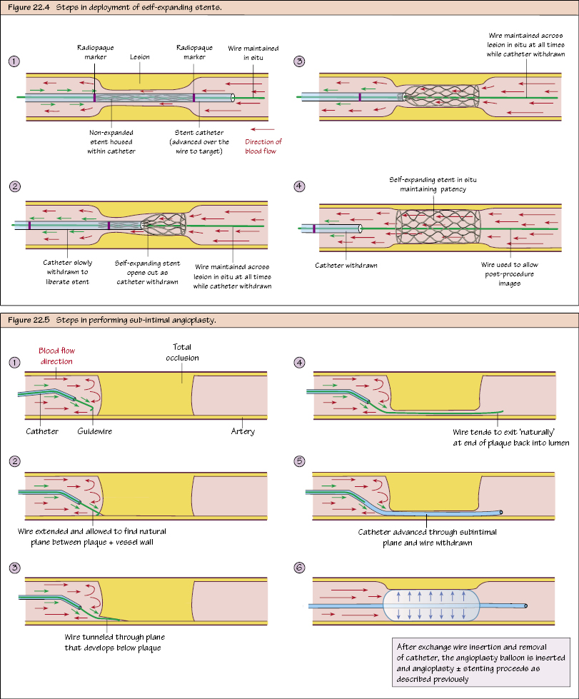 c22-fig-5002