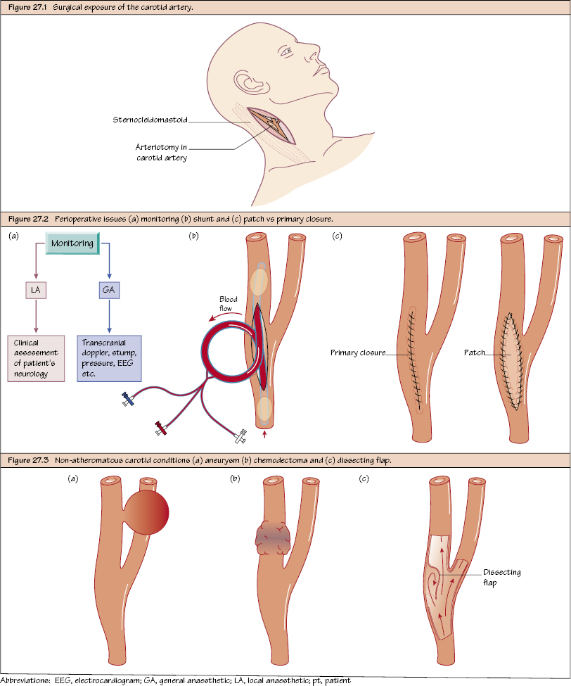 c27-fig-5001