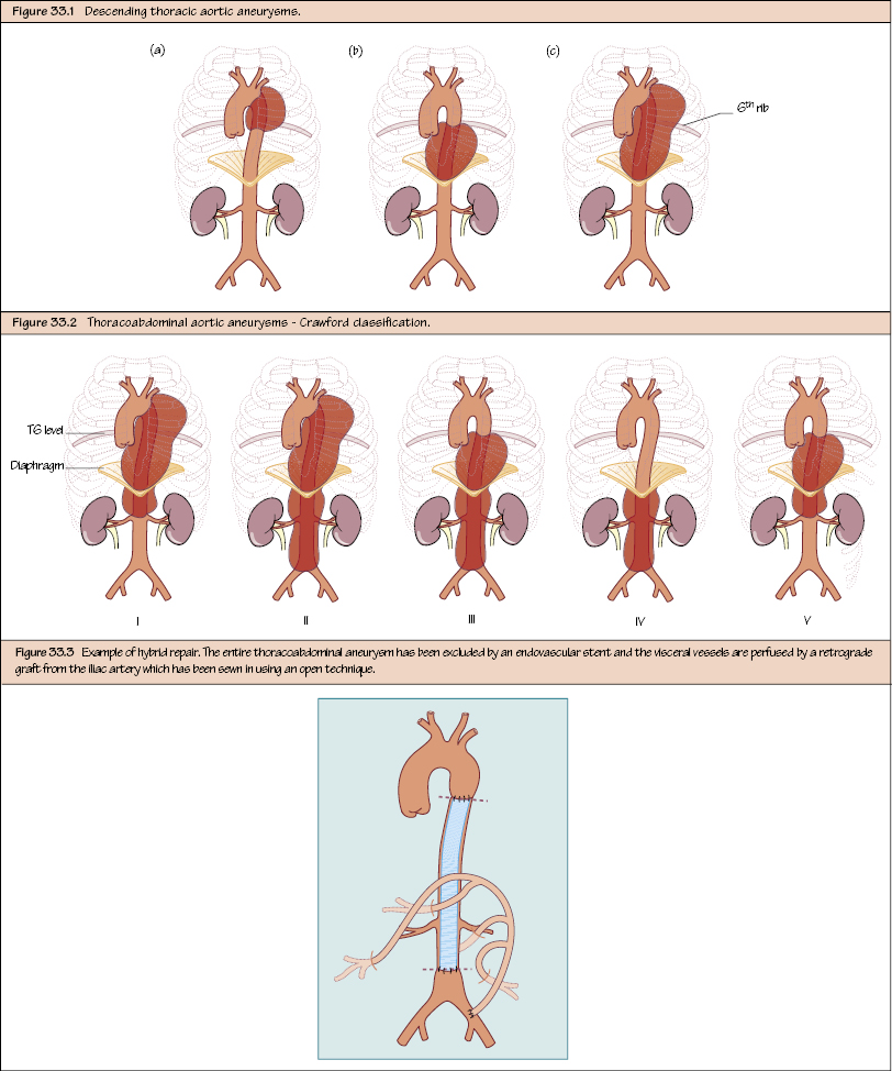 c33-fig-5001