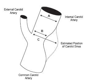 Role of Vascular Ultrasonography in Peripheral Artery Disease ...