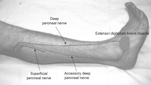 Case 8 Thoracic Key