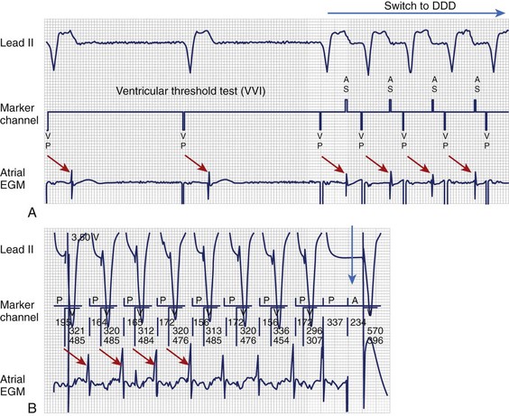 VDD and DDD modes