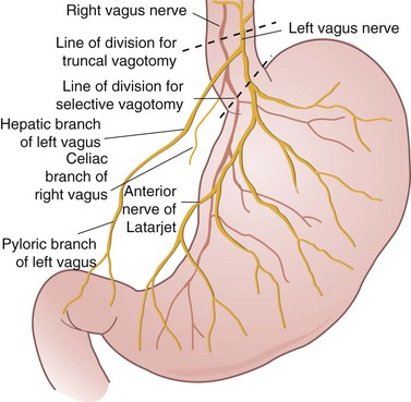 Criminal Nerve of Grassi is 1st branch of posterior vagus